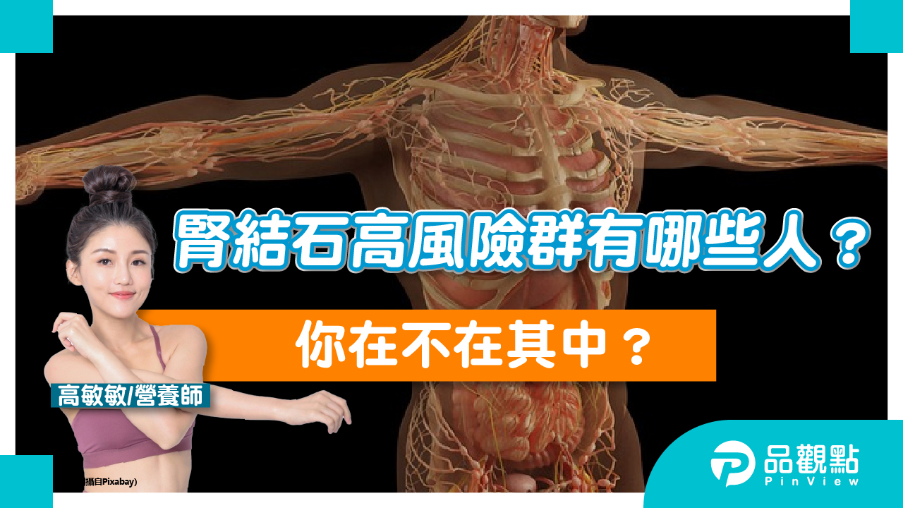 腎結石高風險群有哪些人？你在不在其中？