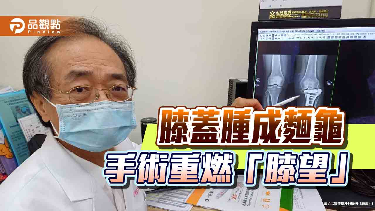 30歲女搬家膝蓋腫成麵龜  人工膝關節換置重燃膝望