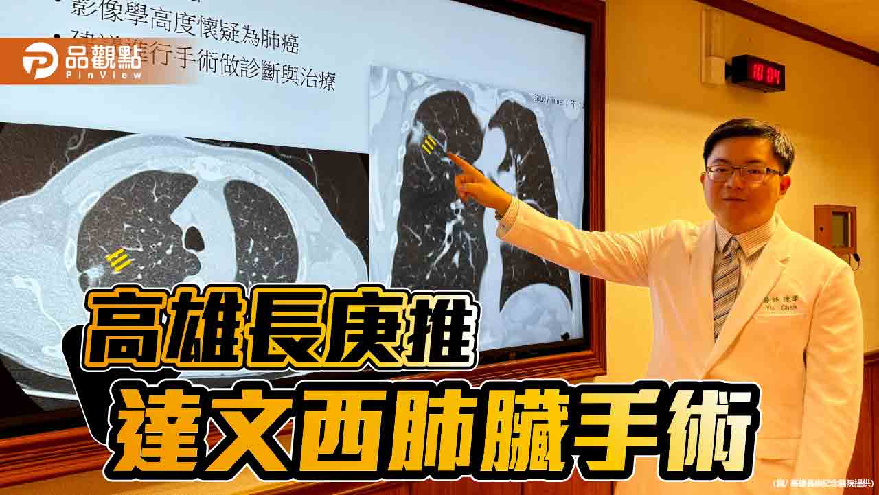 高雄長庚多元高端治療肺癌  推達文西肺臟手術